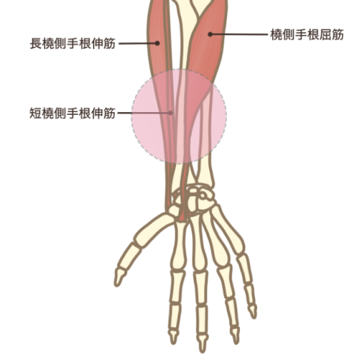 arm arm